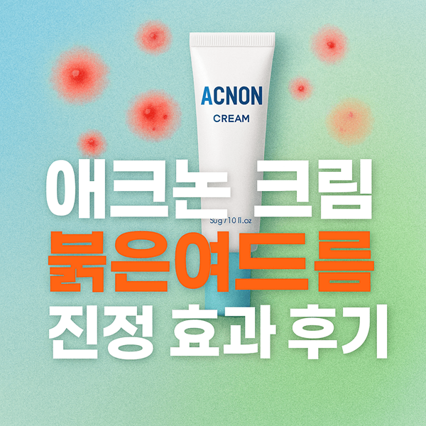에크논 크림 붉은여드름 진정 효과 후기 3주 실사용 경험담 2 애크논 크림 붉은여드름 진정 효과 후기