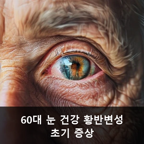 60대 눈 건강 황반변성 초기 증상 관련 대표 이미지
