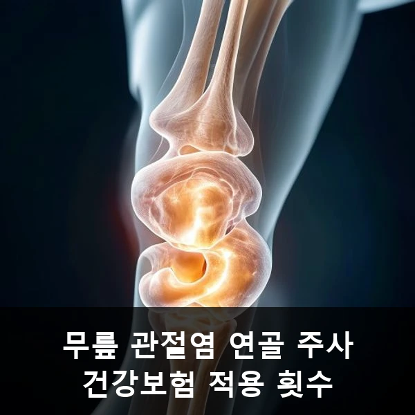 무릎 관절염 연골 주사 건강보험 적용 횟수 관련 대표 이미지