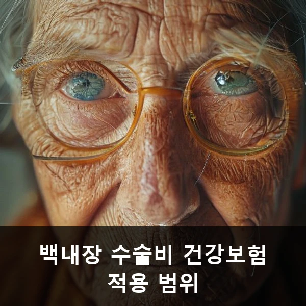 백내장 수술비 건강보험 적용 범위 관련 대표 이미지