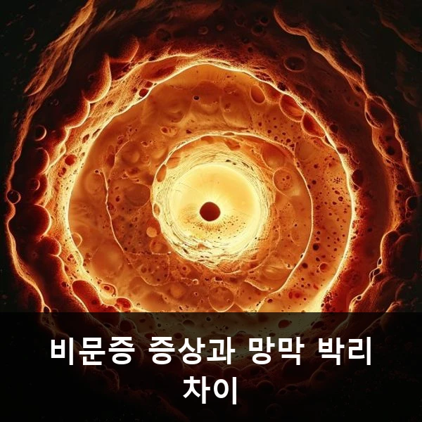 비문증 증상과 망막 박리 차이