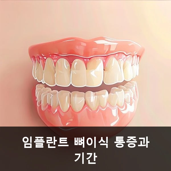 임플란트 뼈이식 통증과 기간 관련 대표 이미지