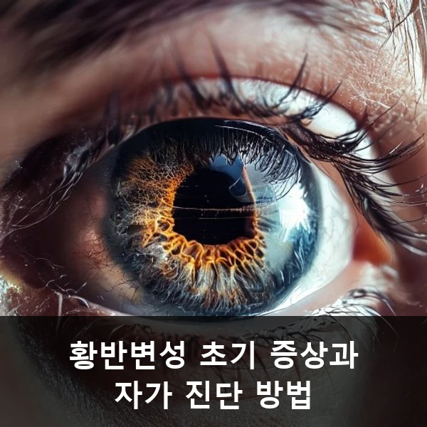황반변성 초기 증상과 자가 진단 방법 관련 대표 이미지