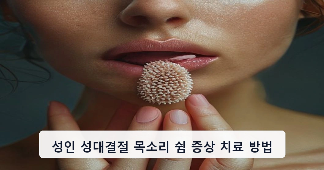 성인 성대결절 목소리 쉼 증상 치료 방법